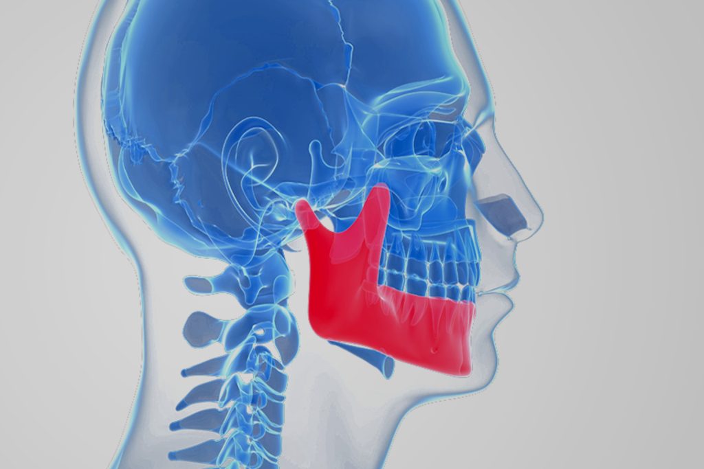 O que é o Prognatismo Mandibular