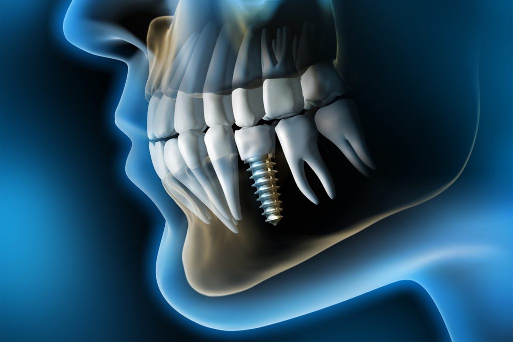 Carron Pozzer Odontologia